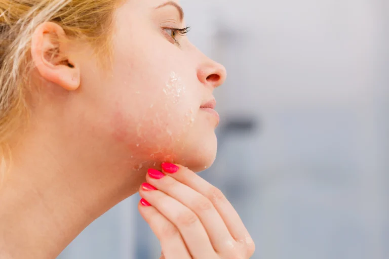 Image 1 oily-dehydrated skin