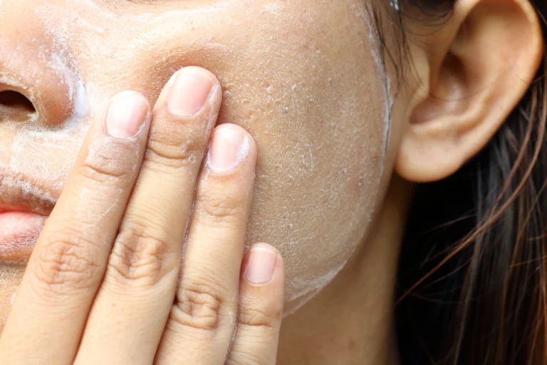 pic 1 - exfoliation face